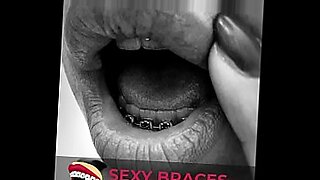 Cute Girls With Braces Showing their smile!